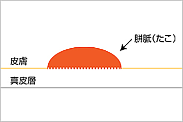形状の分類：標準型のイメージイラスト