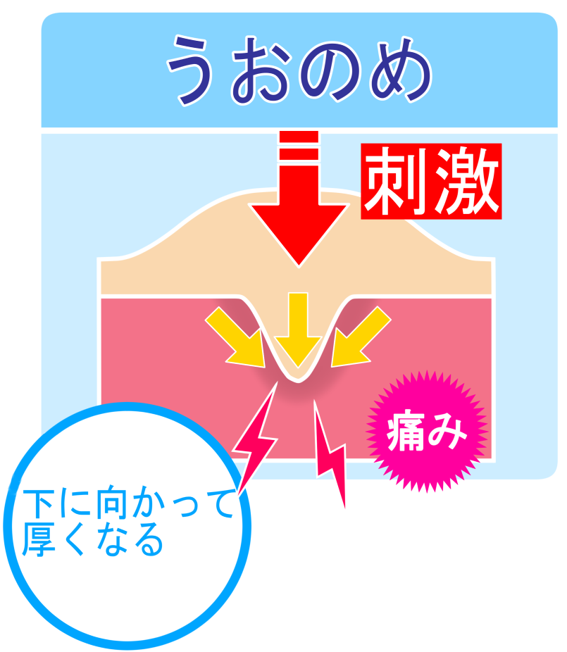 角質ケアについて